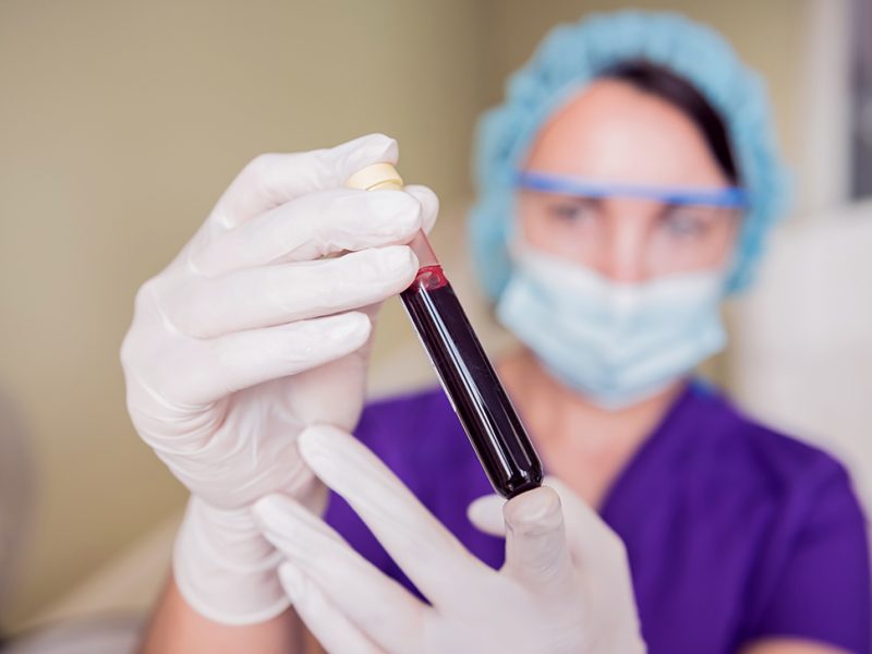 Profesional sanitaria sosteniendo un tubo con la sangre del paciente para obtener los factores de crecimiento